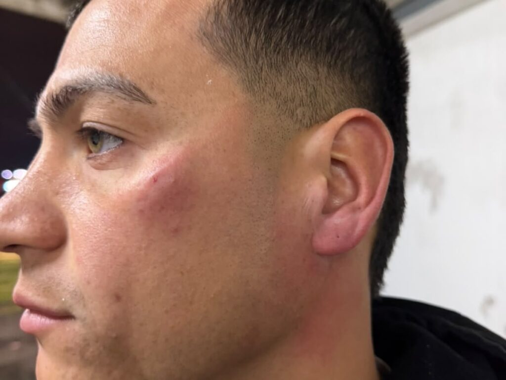 Jugadores de Patronato fueron agredidos por sus hinchas tras haber perdido contra Colón de Santa Fe